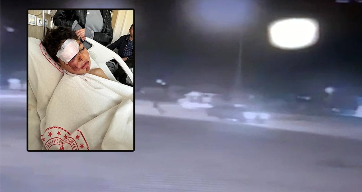 Aksaray’da 12 yaşındaki çocuğa otomobil çarptı