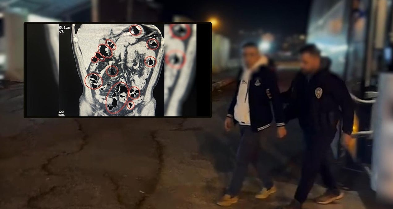 Otobüsten indirildiler, mide ve bağırsaklarından çıkanlar şoke etti